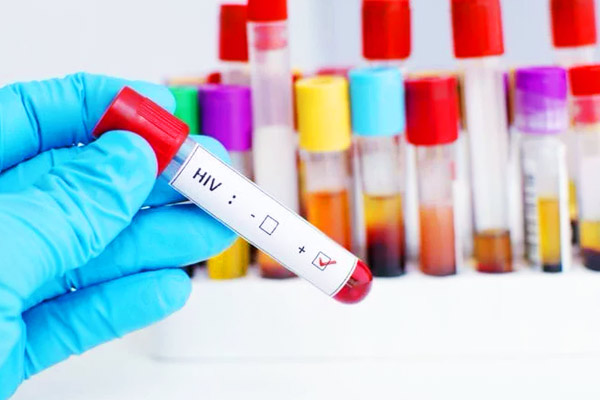 HIV for the first time since the year 2000