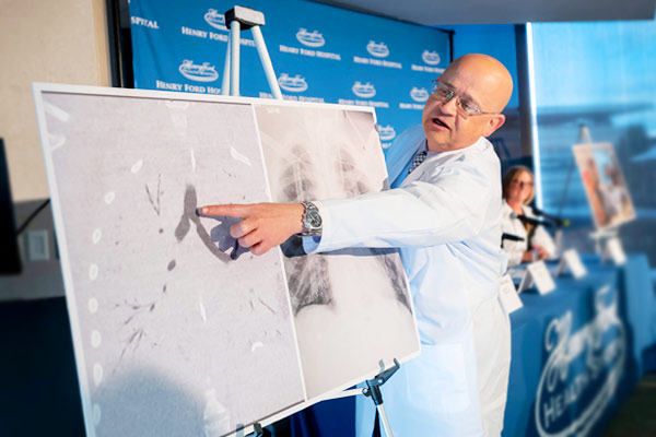 For the first time in the world, American doctors transplant both lungs simultaneously For the first time in the world, American doctors transplant both lungs simultaneously