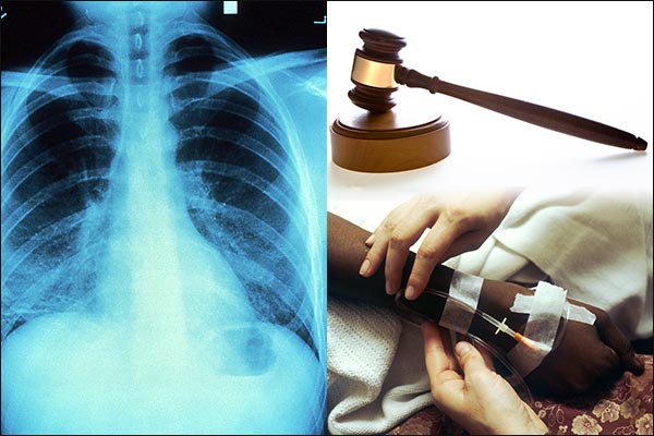 Chemotherapy given 3 times by giving TB patient cancer Chemotherapy given 3 times by giving TB patient cancer