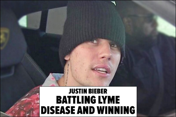 Justin Bieber reveals he is battling Lyme disease Justin Bieber reveals he is battling Lyme disease