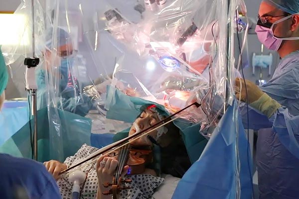 A brain surgery patient and a musician plays violin while doctors remove her tumour A brain surgery patient and a musician plays violin while doctors remove her tumour