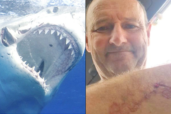 Surfer tells of terrifying shark attack in New Zealand Surfer tells of terrifying shark attack in New Zealand