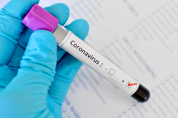 3 new cases of Coronavirus in Ladakh and total count reaches 128 3 new cases of Coronavirus in Ladakh and total count reaches 128