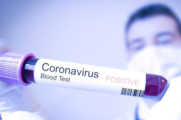 Mumbai man who tested positive for coronavirus took a train to attend a wedding contacted 1000 peopl Mumbai man who tested positive for coronavirus took a train to attend a wedding contacted 1000 peopl