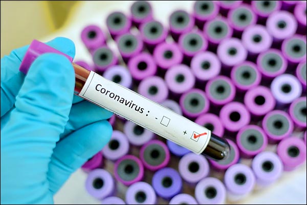 Positive cases breach 200 mark as India reports 5th death due to pandemic Positive cases breach 200 mark as India reports 5th death due to pandemic