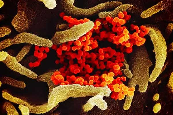 Supercomputer discovered treatment of corona will help to make vaccine Supercomputer discovered treatment of corona will help to make vaccine