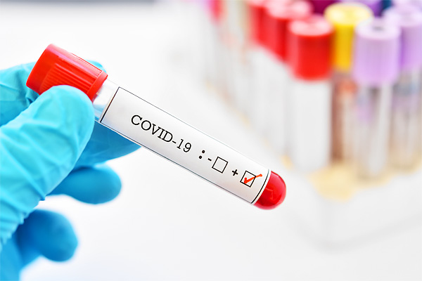 Coronavirus cases in India rise to 4281 death toll climb to 111 Coronavirus cases in India rise to 4281 death toll climb to 111