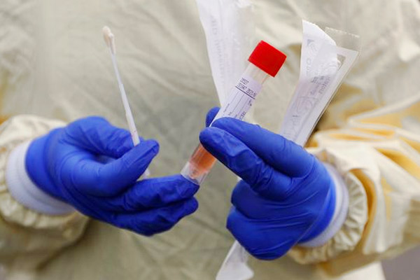 ICMR has updated its testing strategy for coronavirus know all about it ICMR has updated its testing strategy for coronavirus know all about it