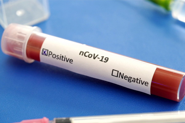 53 journalists test positive for coronavirus in Mumbai 53 journalists test positive for coronavirus in Mumbai
