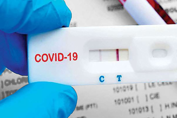 New coronavirus antibody test approved by England to check if a person develops immunity New coronavirus antibody test approved by England to check if a person develops immunity