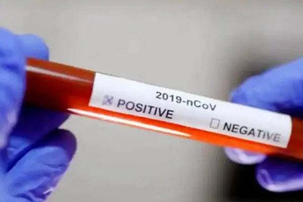 Anti-parasitic drug effective against COVID-19 in animal tests: Daewoong Pharmaceutical