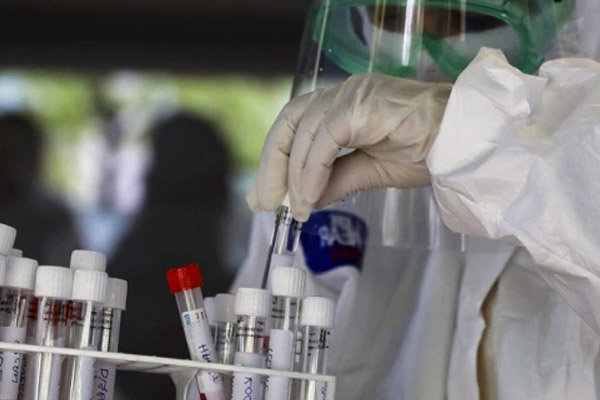 So far 2,76,94,416 corona tests have been conducted in the country only America ahead of India So far 2,76,94,416 corona tests have been conducted in the country only America ahead of India