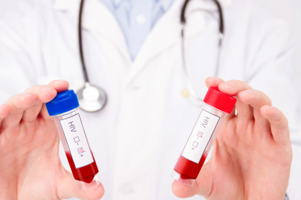 HIV Positive HIV Positive